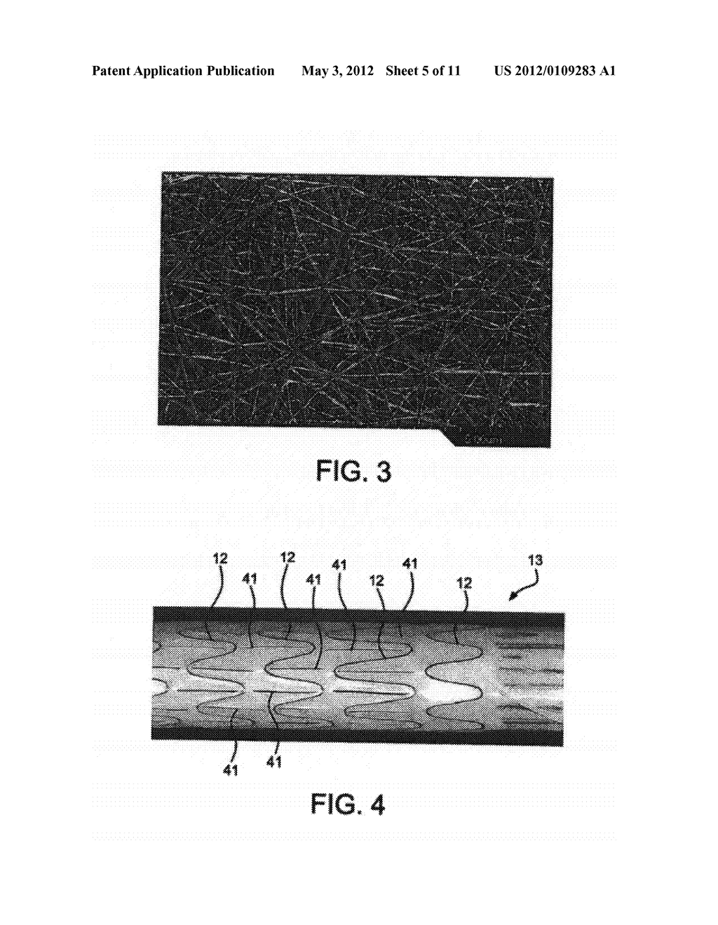 STENT HAVING ADJACENT ELEMENTS CONNECTED BY FLEXIBLE WEBS - diagram, schematic, and image 06