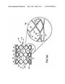 STENT HAVING ADJACENT ELEMENTS CONNECTED BY FLEXIBLE WEBS diagram and image