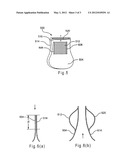 Artificial Valve Prosthesis with a Free Leaflet Portion diagram and image