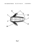 Intervertebral Implant diagram and image