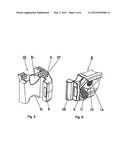 Intervertebral Implant diagram and image