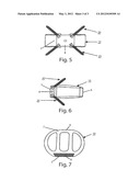 INTERVERTEBRAL IMPLANT diagram and image