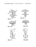 Modular Humeral Head Resurfacing System diagram and image