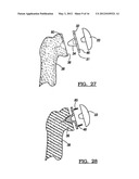 Modular Humeral Head Resurfacing System diagram and image