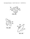 Modular Humeral Head Resurfacing System diagram and image