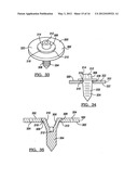 Modular Humeral Head Resurfacing System diagram and image