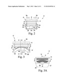 Prosthetic Device with Multi-Axis Dual Bearing Assembly and Methods for     Resection diagram and image