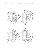 Prosthetic Device with Multi-Axis Dual Bearing Assembly and Methods for     Resection diagram and image