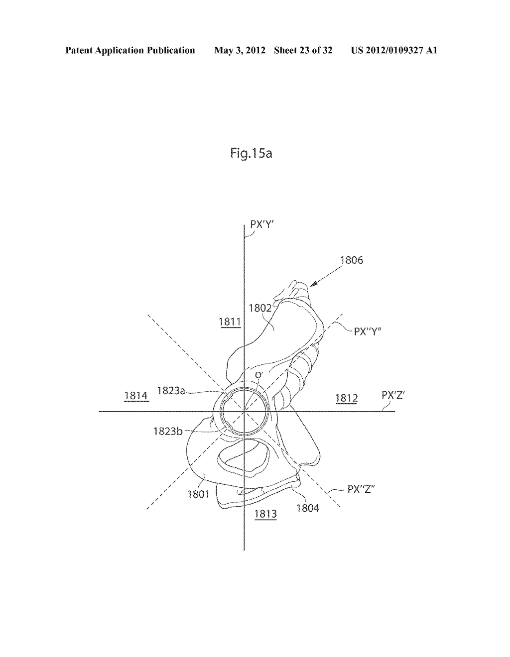 HIP JOINT DEVICE - diagram, schematic, and image 24