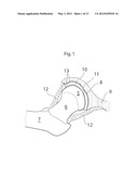 HIP JOINT DEVICE, SYSTEM AND METHOD diagram and image