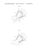 HIP JOINT DEVICE, SYSTEM AND METHOD diagram and image