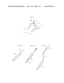 HIP JOINT DEVICE, SYSTEM AND METHOD diagram and image