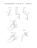 HIP JOINT DEVICE, SYSTEM AND METHOD diagram and image