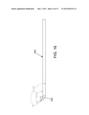 METHOD AND APPARATUS FOR RESTORING ARTICULAR CARTILAGE diagram and image