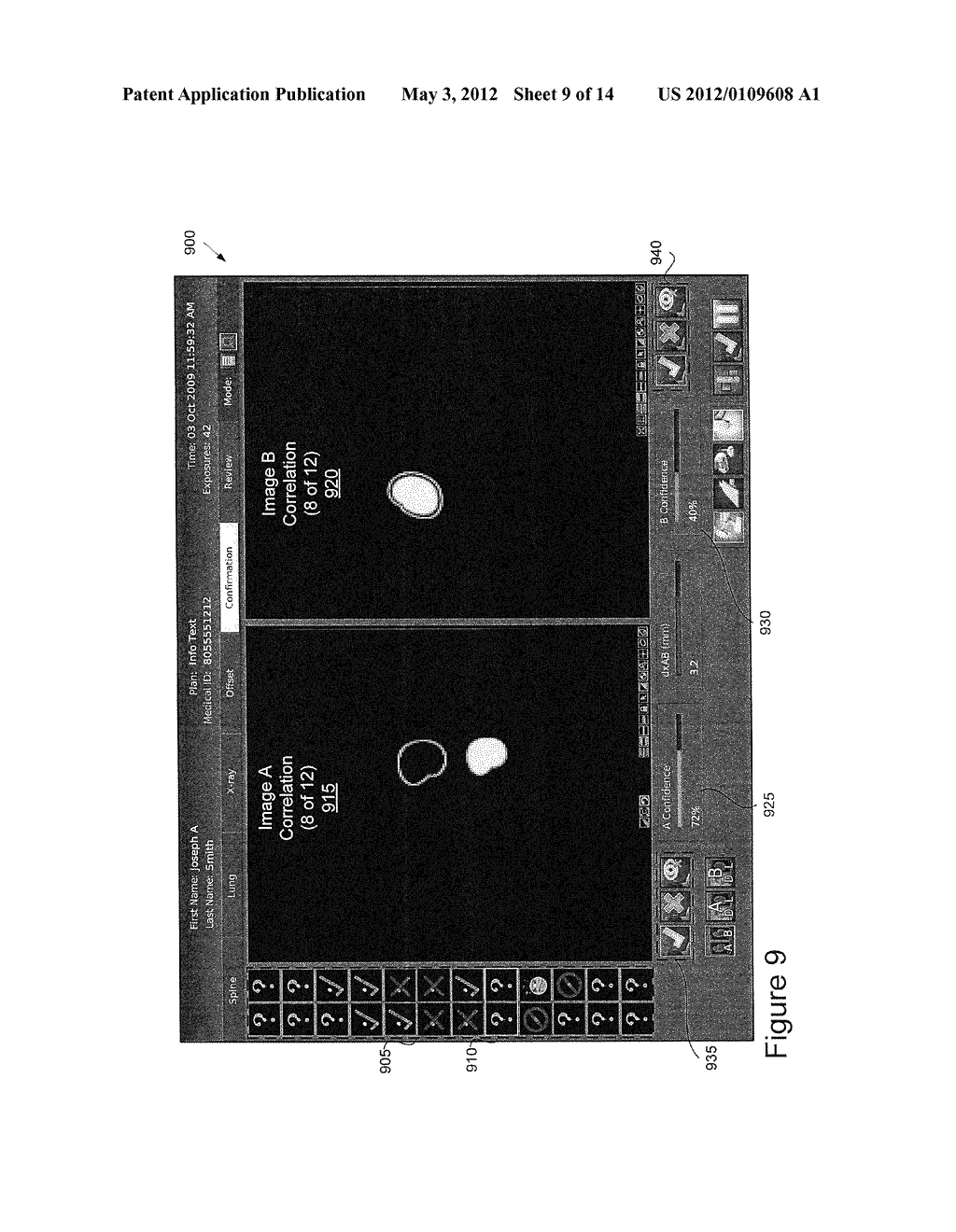 METHOD AND APPARATUS FOR SELECTING A TRACKING METHOD TO USE IN IMAGE     GUIDED TREATMENT - diagram, schematic, and image 10