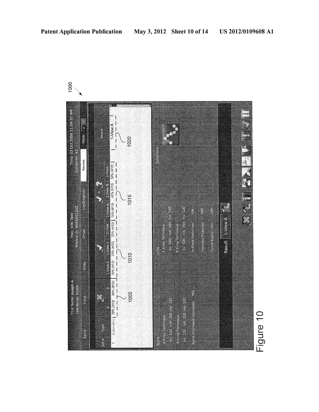 METHOD AND APPARATUS FOR SELECTING A TRACKING METHOD TO USE IN IMAGE     GUIDED TREATMENT - diagram, schematic, and image 11