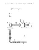 Clip for Mounting a Fluid Delivery Device diagram and image