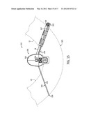 Clip for Mounting a Fluid Delivery Device diagram and image