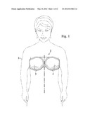 REDUCED-PRESSURE, COMPRESSION SYSTEMS AND APPARATUSES FOR USE ON BREAST     TISSUE diagram and image