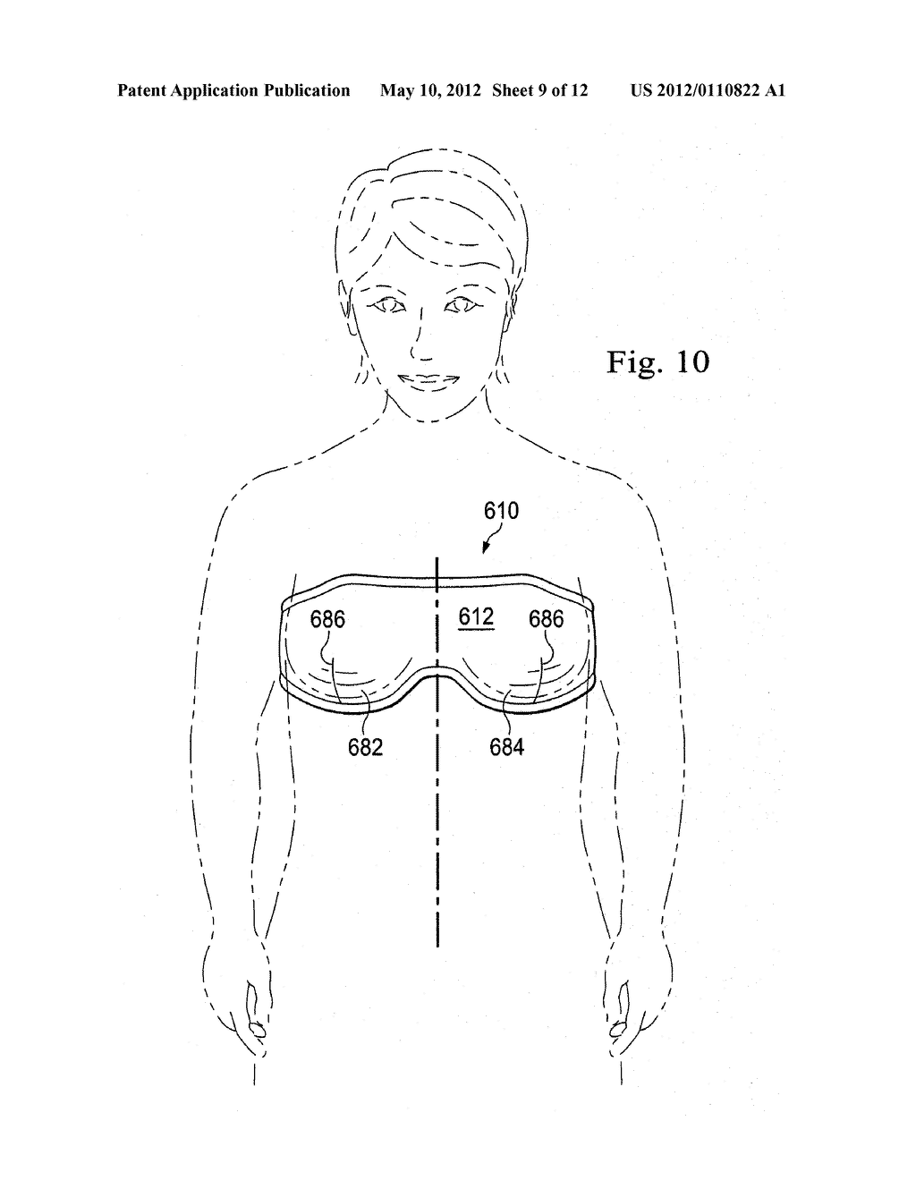 REDUCED-PRESSURE, COMPRESSION SYSTEMS AND APPARATUSES FOR USE ON BREAST     TISSUE - diagram, schematic, and image 10