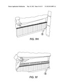 BEDBUG DETECTION DEVICE AND METHOD diagram and image