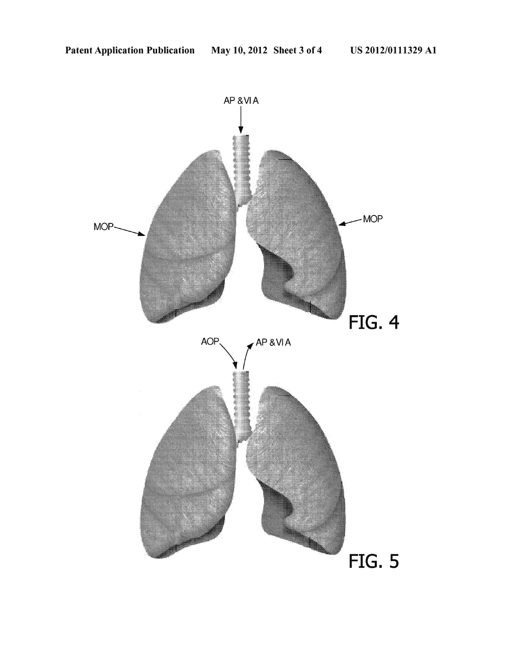 DEVICE AND METHOD FOR ASSISTING A COUGH - diagram, schematic, and image 04