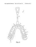 CUSTOM MOUTHGUARD diagram and image