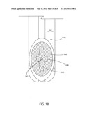 FLOSS PICK diagram and image