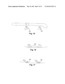 SYSTEMS AND METHODS FOR PROVIDING  DISHWARE HAVING A UTENSIL RETAINER diagram and image