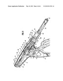 Surgical Stapling Device diagram and image