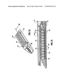 Surgical Stapling Device diagram and image