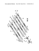 Surgical Stapling Device diagram and image