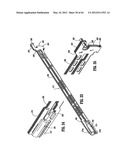 Surgical Stapling Device diagram and image