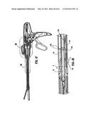 Surgical Stapling Device diagram and image