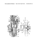 Surgical Stapling Device diagram and image