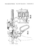 Surgical Stapling Device diagram and image