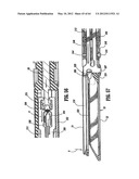 Surgical Stapling Device diagram and image