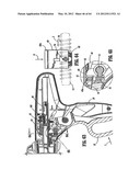 Surgical Stapling Device diagram and image