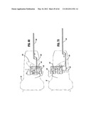 Surgical Stapling Device diagram and image