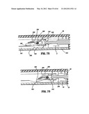 Surgical Stapling Device diagram and image