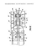 Surgical Stapling Device diagram and image