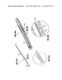 Surgical Stapling Device diagram and image