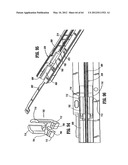 Surgical Stapling Device diagram and image