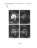 T2-weighted and diffusion-weighted imaging using fast acquisition with     double echo (FADE) diagram and image