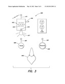 REMOTE MEDICAL DEVICE ALARM diagram and image