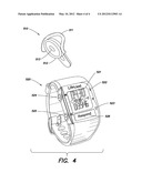 REMOTE MEDICAL DEVICE ALARM diagram and image