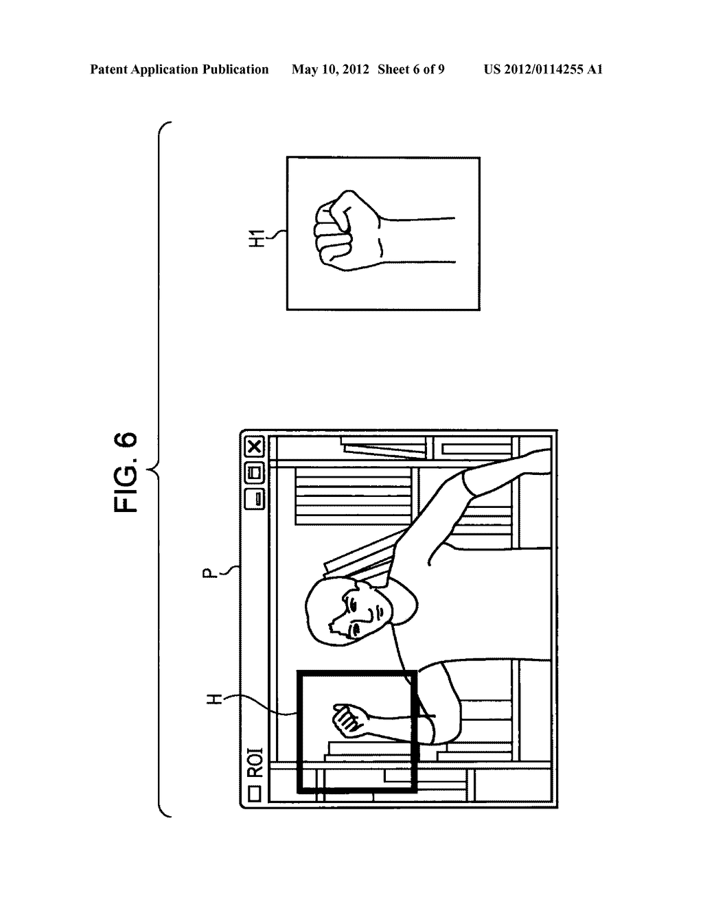 IMAGE PROCESSING APPARATUS, METHOD, AND PROGRAM - diagram, schematic, and image 07