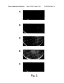 BACTERIOPHAGE-CONTAINING THERAPEUTIC AGENTS diagram and image