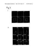 PROTEIN WITH PROMOTING EFFECTS FOR AXONAL GROWTH OF NEURONS OF CENTRAL     NERVOUS SYSTEM diagram and image