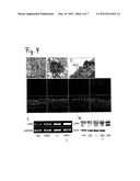 PROTEIN WITH PROMOTING EFFECTS FOR AXONAL GROWTH OF NEURONS OF CENTRAL     NERVOUS SYSTEM diagram and image